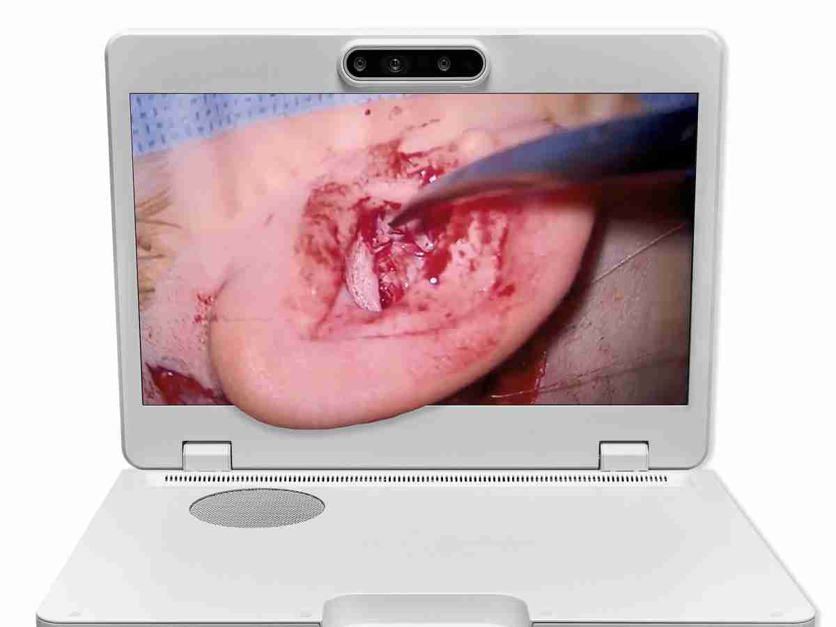 达擎之＂Heads-up 3D显微手术显示系统＂，，整合4K裸眼3D显示及眼球追踪系统，，，具备快速追踪人眼移动位置功能，，，减轻医师长时间维持固定姿势的负担，，让医师能有更宽广清晰的3D立体视野及更舒适的姿势来执行手术。。。